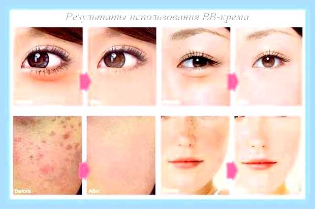 В чем разница между ссд и хдд